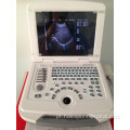 Exibir LED Vascular Laptop Ultrassom Scanner Preço